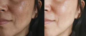 intimate lightening
