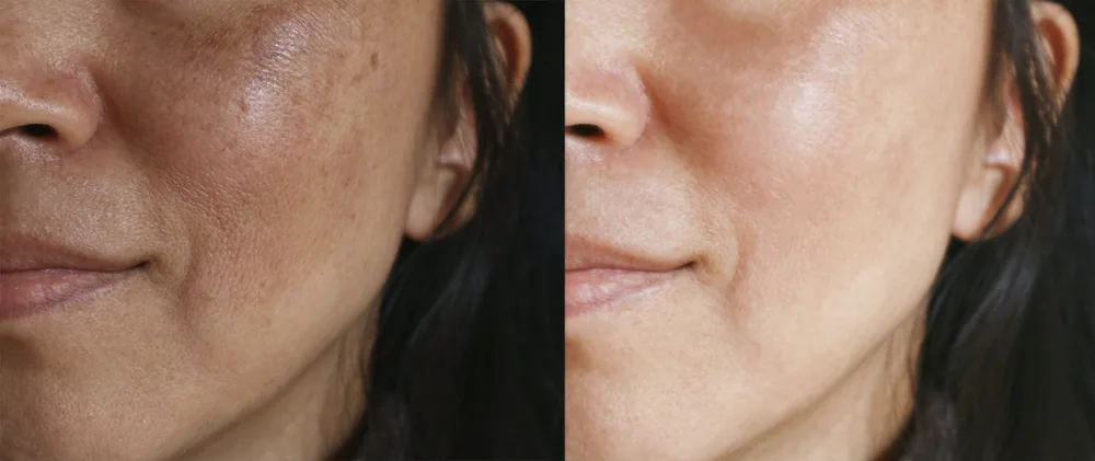 intimate lightening