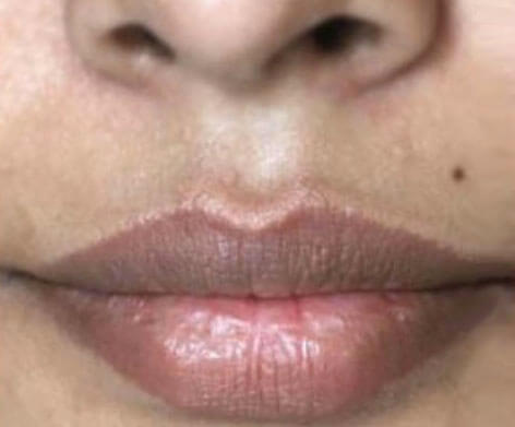 Intimate Lightening Lips