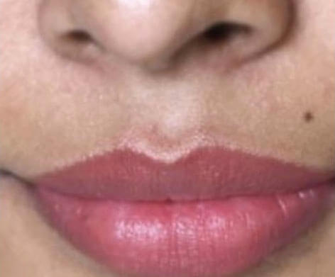 Intimate Lightening Lips