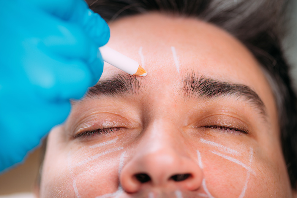 Is There a Difference Between Botox and Fillers?