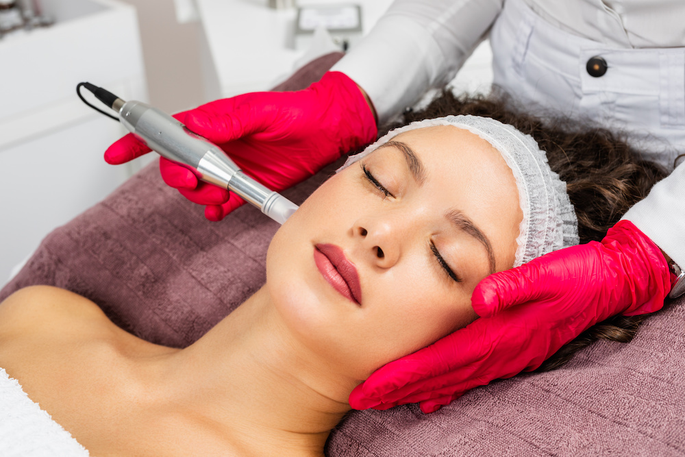 Top Benefits of Microneedling