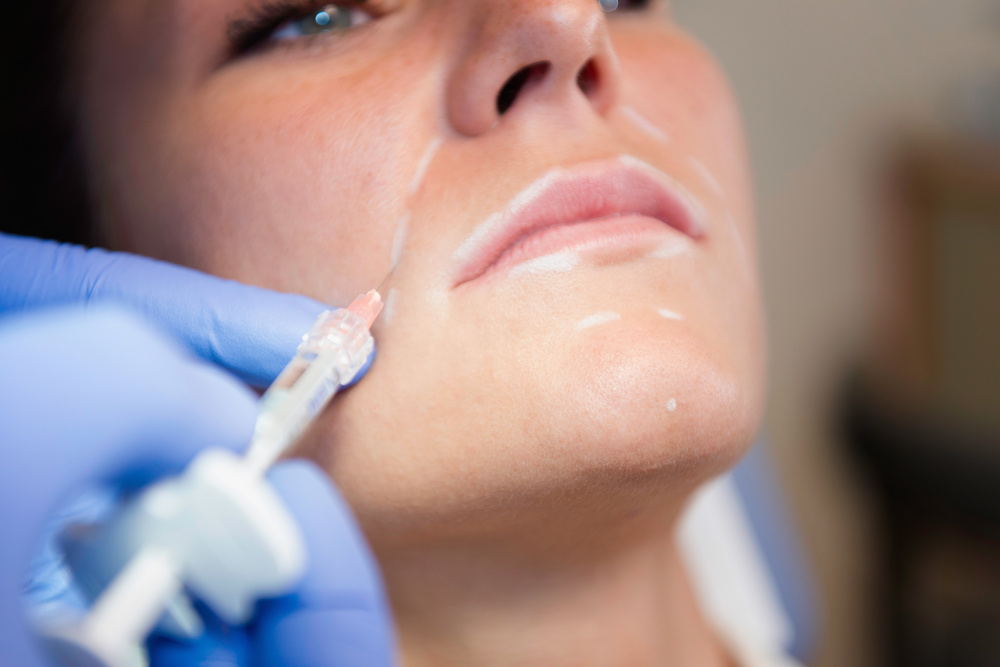 Which Type of Filler is Best For You?